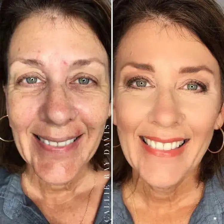 Smooth &amp; Glow Kit
