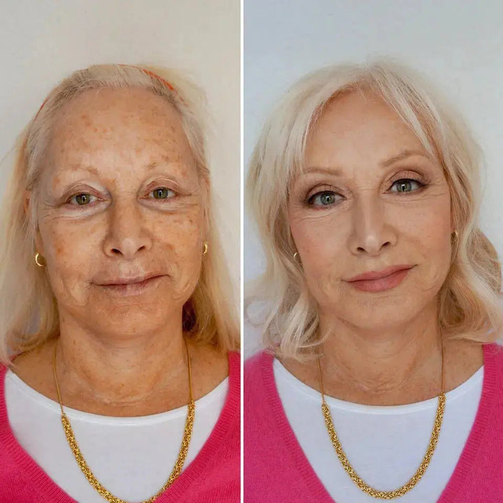 Reverse-aging Adaptive Foundation