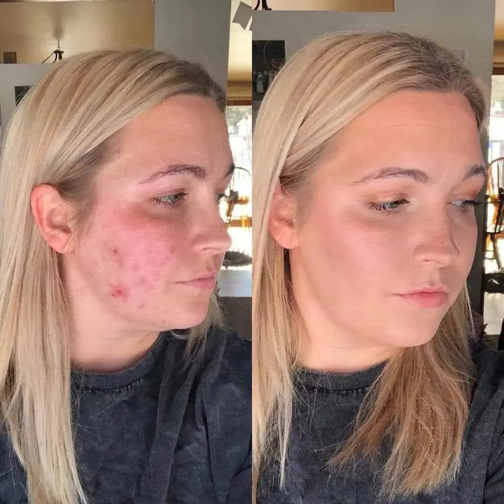 Reverse-aging Adaptive Foundation