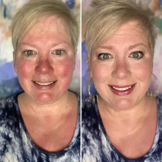 Reverse-aging Adaptive Foundation