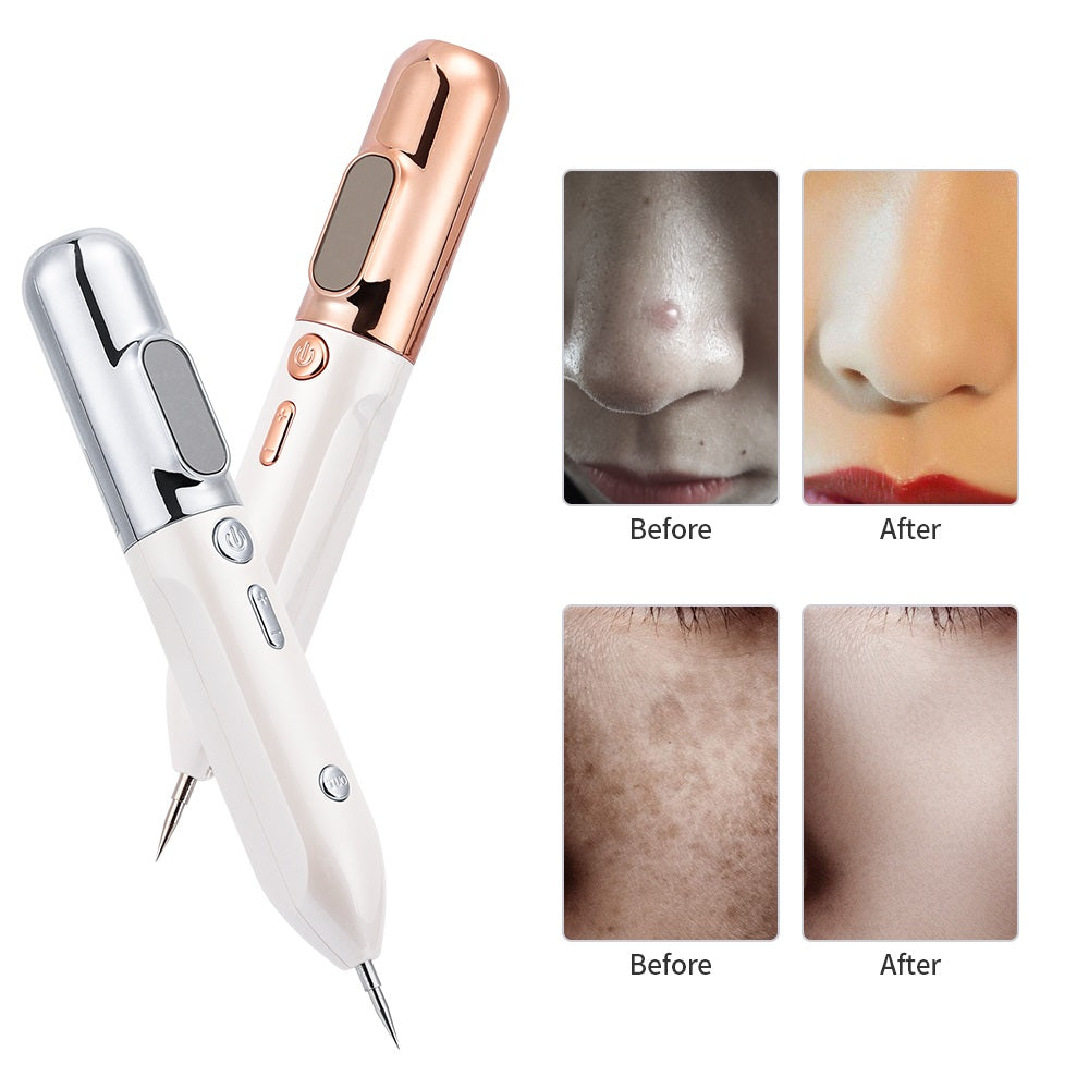 BowLift | HexoPen️ Wart &amp; Skin Tag Removal Plasma Pen