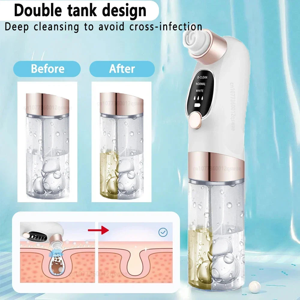 BowLift | Acne Black Head Deep Clean Removal