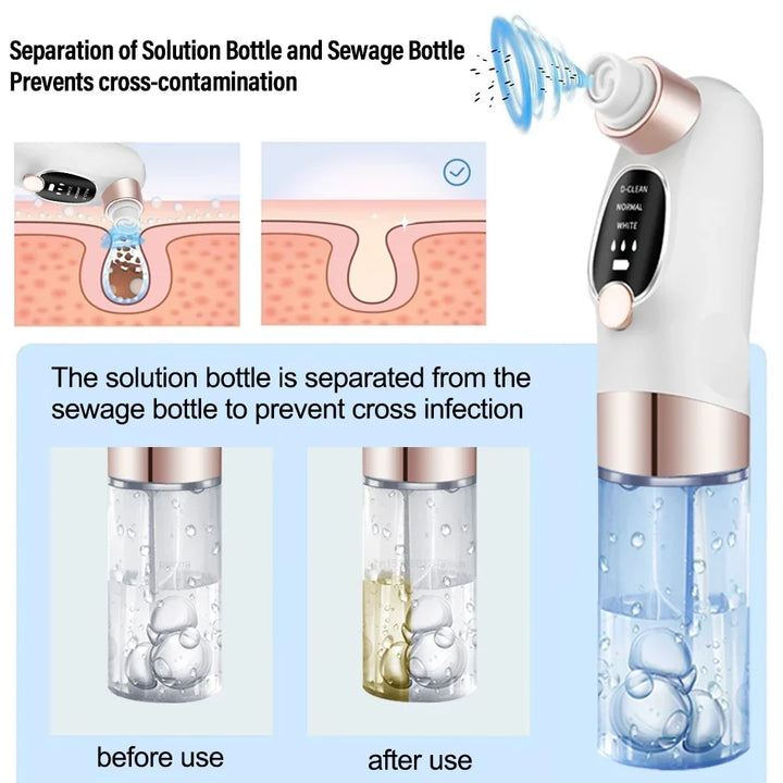 Deluxe Blackhead Remover Pore Vacuum Cleaner - 6-Probe Suction Facial Cleaner