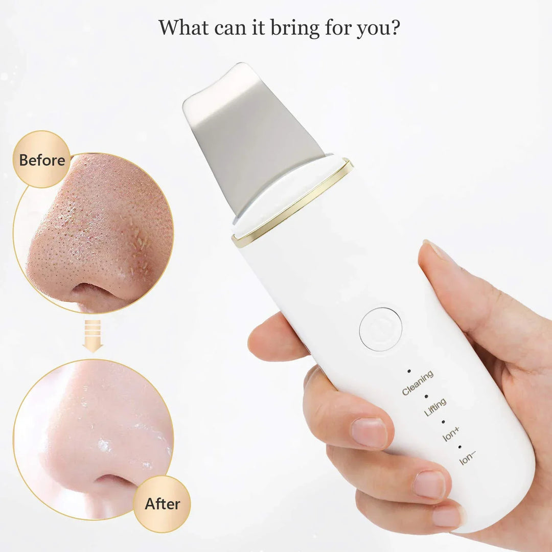 Ultrasonic Skin Scrubber &amp; Pore Cleaner - 4-in-1 Facial Spatula