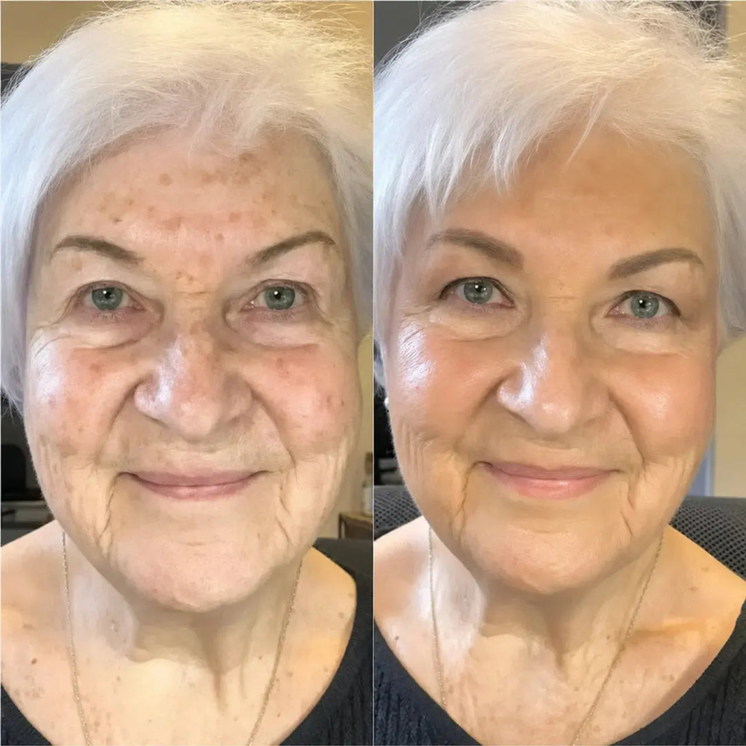 Reverse-aging Adaptive Foundation