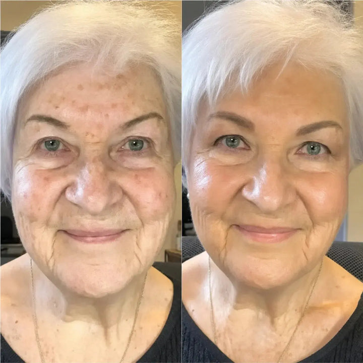 Reverse-aging Adaptive Foundation
