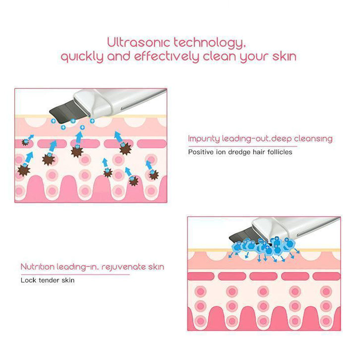 BowLift | Deep Cleansing Ultrasonic Skin Revitalizer